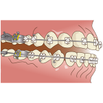 orthodontics046